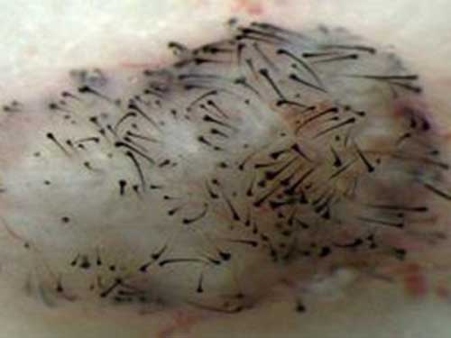 Tế bào da nhú từ hPSC kích thích chuột mọc lông. Ảnh: MNT