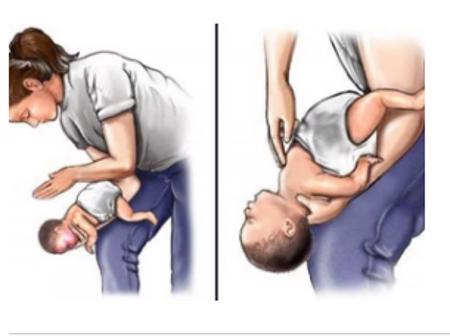 Hóc dị vật đường thở, nguy cơ tử vong cao