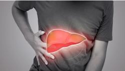 Mắc bệnh gan nhiễm mỡ vì thứ tưởng rằng "lành mạnh"