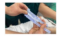 Mức sinh năm 2025 tăng nhưng chưa đạt ngưỡng thay thế