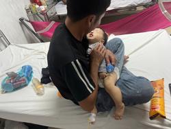 Công an xác minh thông tin bé 9 tháng tuổi bị bầm tím 2 má