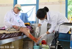 Nữ điều dưỡng hết lòng vì bệnh nhân phong