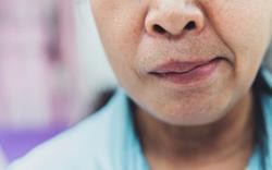 Mưa gió, nhiều người ngủ dậy bỗng méo miệng