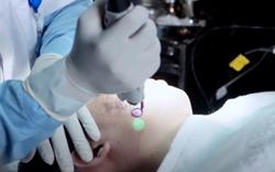 Sau ủ trắng da, cô gái nhập viện vì rối loạn nhịp tim