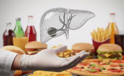 Vài tuần làm điều này có thể giảm được gan nhiễm mỡ