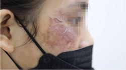 Mỹ phẩm online chưa thôi gây họa