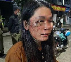 Diễn biến mới vụ nữ shipper tố bị khách hàng hành hung