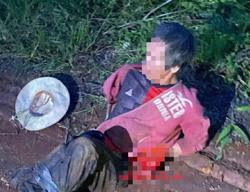 Bị người bệnh thần kinh dùng đá đập đầu, một thanh niên nguy kịch