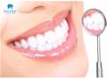 Bọc răng sứ Orodent có thực sự tốt không? Những thông tin quan trọng cần nắm!
