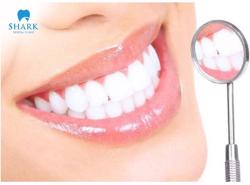 Bọc răng sứ Orodent có thực sự tốt không? Những thông tin quan trọng cần nắm!