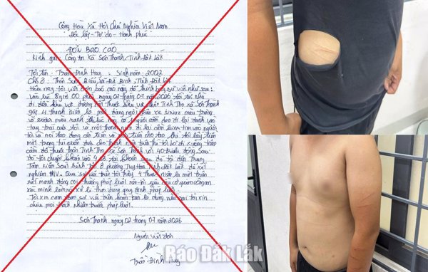 Tự gây thương tích, dựng chuyện bị cướp 40 triệu đồng để báo tin giả