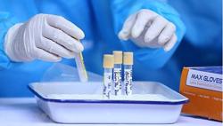 Hải Dương: Phát hiện 1 nữ sinh nghi nhiễm Covid-19 thông qua xét nghiệm cho học sinh, sinh viên