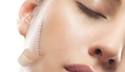 Vì sao phải cân nhắc khi đi làm đẹp ở thẩm mỹ viện