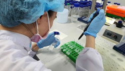 Liên tục nâng công suất xét nghiệm