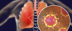 SARS-CoV-2 tấn công phổi như thế nào?