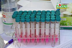 2 trường hợp liên quan đến ổ dịch "hội thánh truyền giáo Phục hưng" đã cho kết quả âm tính lần 1