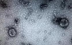 NÓNG: Xác định nhân viên quán bar nhiễm chủng SARS-CoV-2 của Ấn Độ lây lan nhanh