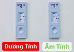 Bộ Y tế cảnh báo sử dụng test nhanh SARS-CoV-2 bán trên mạng