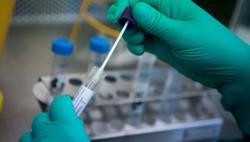 Mức giá xét nghiệm Covid-19