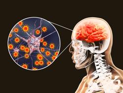 Thời tiết nắng nóng, làm gì để cảnh giác với bệnh viêm não Nhật Bản?