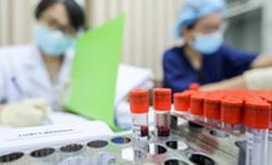 Việt Nam thử nghiệm, nhận chuyển giao công nghệ điều trị Covid-19 của Pháp