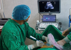 Bệnh viện Đa khoa vùng Tây Nguyên thực hiện thành công phương pháp hủy khối u bằng sóng cao tần