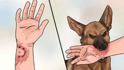 Ca mắc bệnh dại tử vong đều do không tiêm phòng