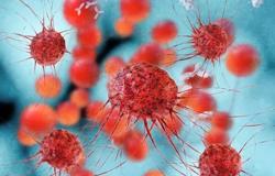 Gặp điều tưởng không liên quan này, tử vong do ung thư tăng 2,4 lần