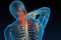 Bệnh nhân thoái hóa đốt sống cổ ngày càng trẻ hóa