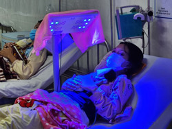 Cần phát hiện và điều trị sớm vàng da bệnh lý ở trẻ sơ sinh