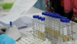 Phát hiện 5 ca nhiễm biến chủng Omicron trong cộng đồng nhờ tầm soát ngẫu nhiên