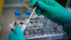 Áp dụng giá dịch vụ xét nghiệm Covid-19 mới từ hôm nay