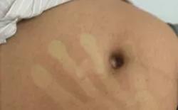 1 tháng, hơn 4.200 ca mắc sốt xuất huyết, đã có người tử vong