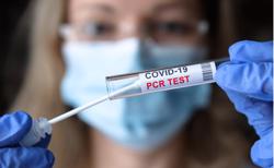 PCR với TC 31,1 - có nguy cơ lây không?