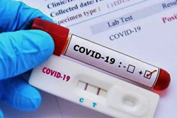 Test nhanh âm tính đã an tâm chưa?