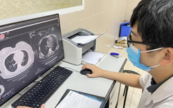 Khỏi Covid-19 bao lâu thì nên tập thể thao trở lại?