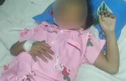 Đắk Lắk: Hạn chế sử dụng nguồn nước gần nơi phát hiện ca mắc "vi khuẩn ăn thịt người"