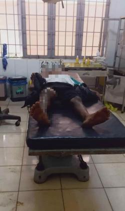 Công an thông tin chính thức vụ bé trai bị đốt