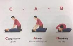 Sơ cứu đúng cách người bị đột qụy