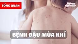 Tổng quan về bệnh đậu mùa khỉ: Bệnh đậu mùa khỉ là gì? Dấu hiệu và cách phòng tránh