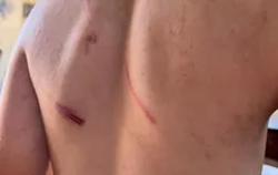 Khởi tố cha và bà nội đánh đập dã man cháu bé 9 tuổi