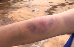 Vụ cháu bé 9 tuổi bị bà và cha đánh đập dã man: Người mẹ nói gì?