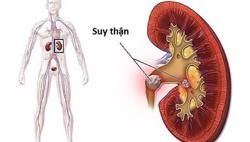 Tổn thương thận do đái tháo đường ngày càng tăng