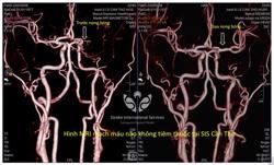 Ở Mỹ không phát hiện, về Việt Nam tìm ra bệnh hiểm