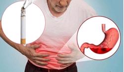 Hút thuốc lá và các vấn đề liên quan đến đường tiêu hóa