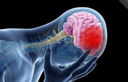 Đột quỵ sẽ tăng vọt, đặc biệt ở châu Á: Cảnh báo 4 lý do chính