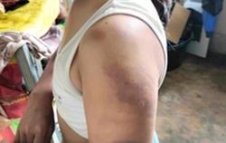 Mười học sinh lớp 4 đánh bạn dã man