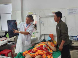 Bệnh viện Đa khoa vùng Tây Nguyên cấp cứu thành công một trường hợp bị tai nạn đa chấn thương