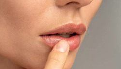 Chăm sóc đôi môi nứt nẻ ngày lạnh