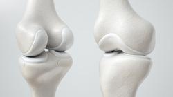 Can thiệp chiều cao khi nào hiệu quả?